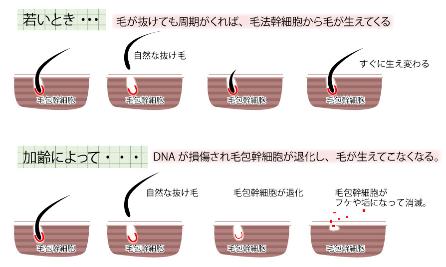 「歳をとると毛が薄くなる仕組みを解明」